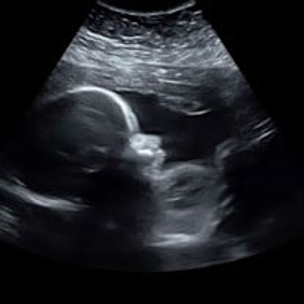 Baby Carson Austin Llewellyn