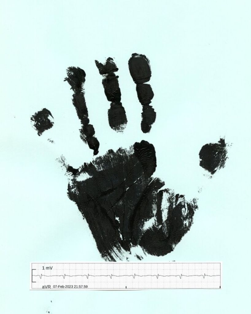 Wilfred "Chuck" Charles Partridge Iii