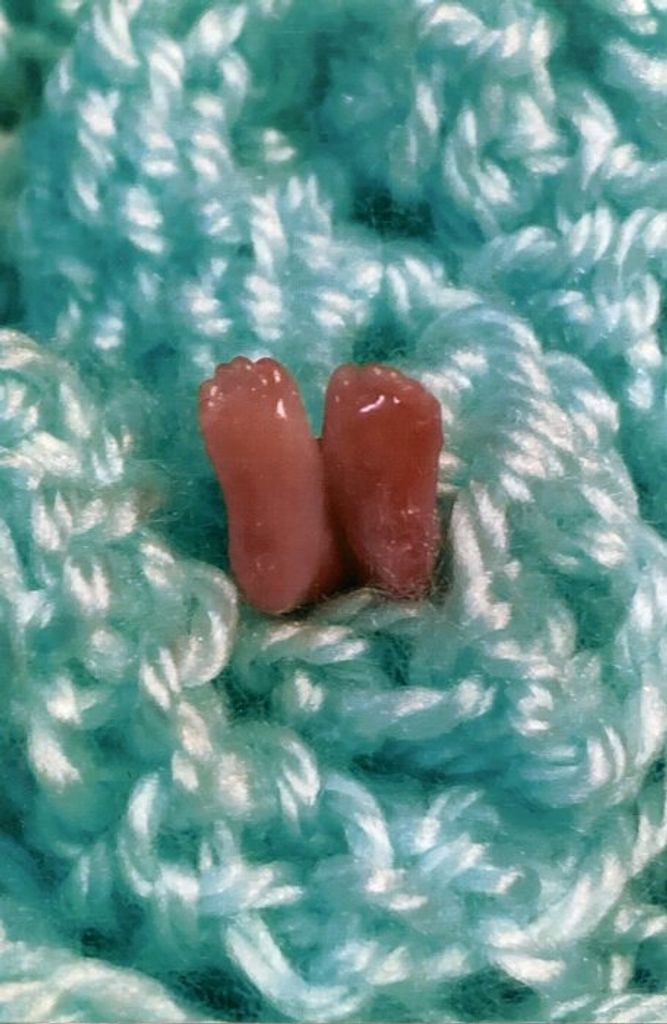 Baby Phillips