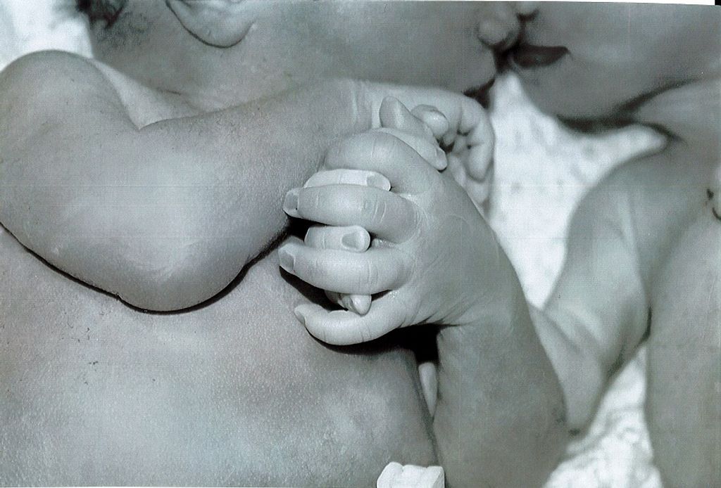 Babies Robert and Scott Thomas-Kellett