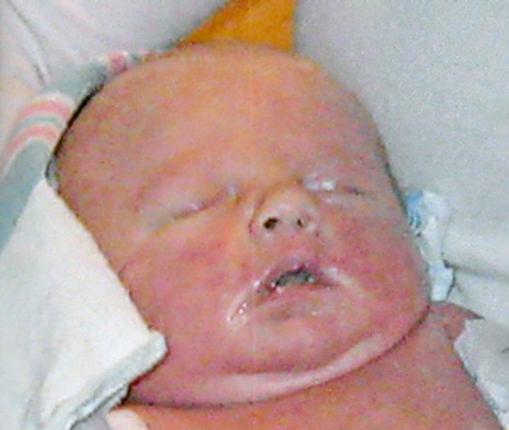Kyndall Ehlers
