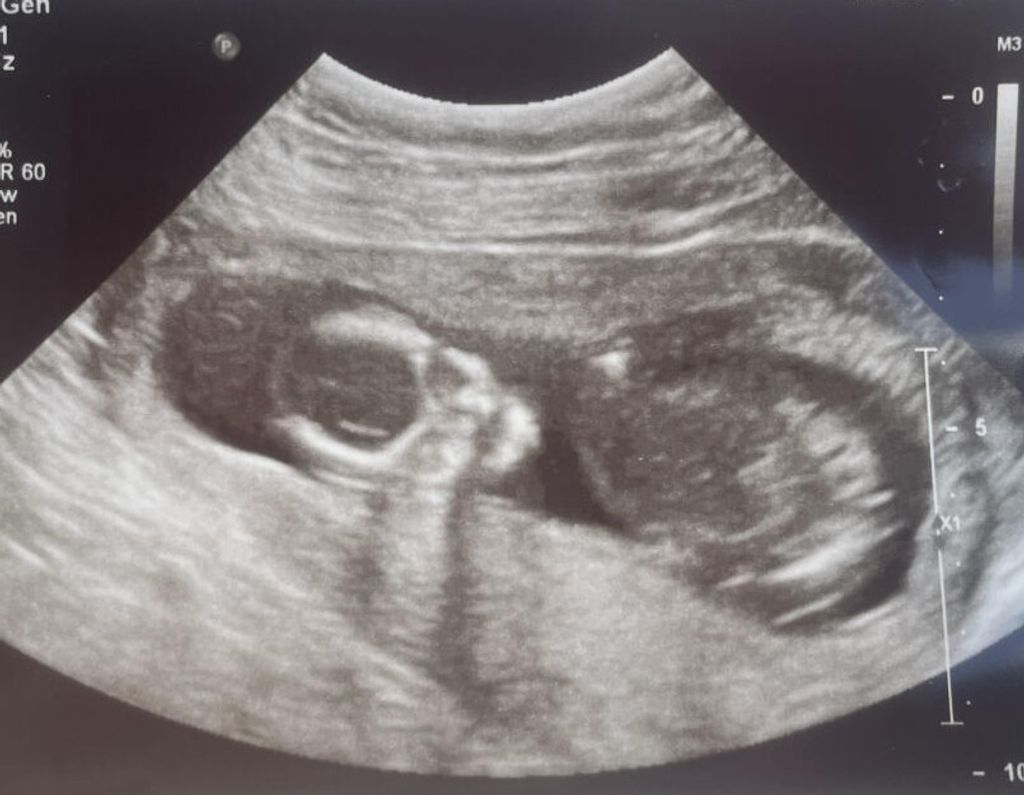 Lorinda Dawn Soluri-Doane