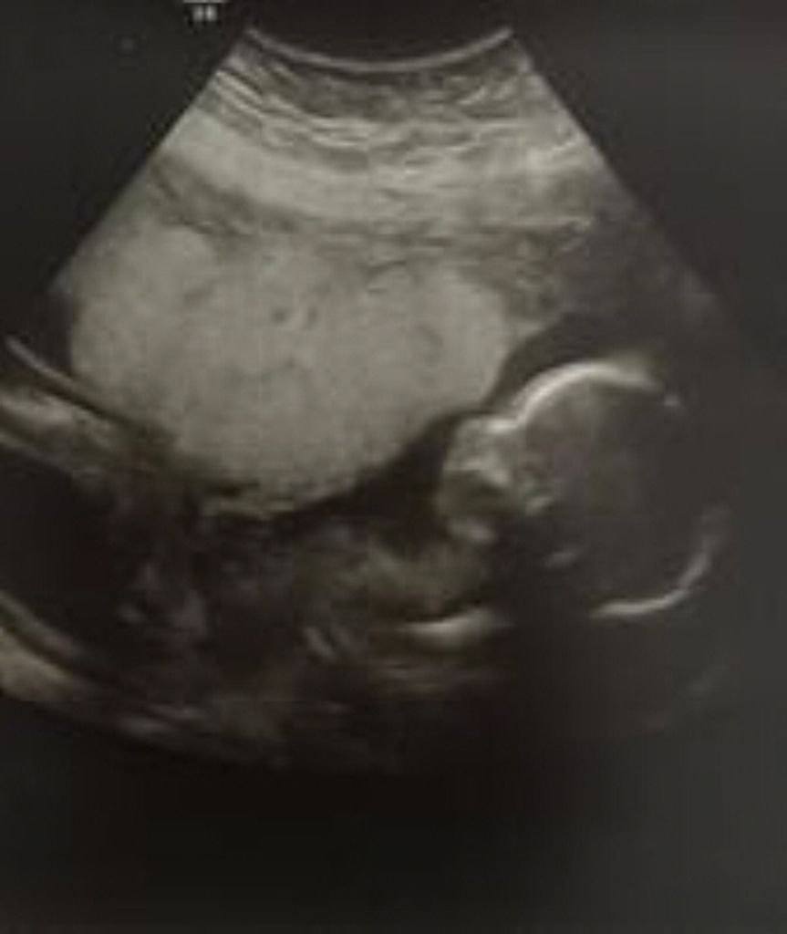 Gracelyn Renteria Profile Photo