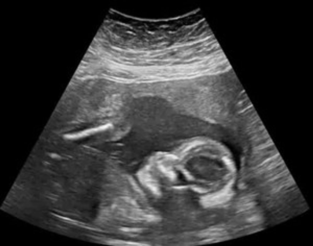 Spencer Irving Christenson