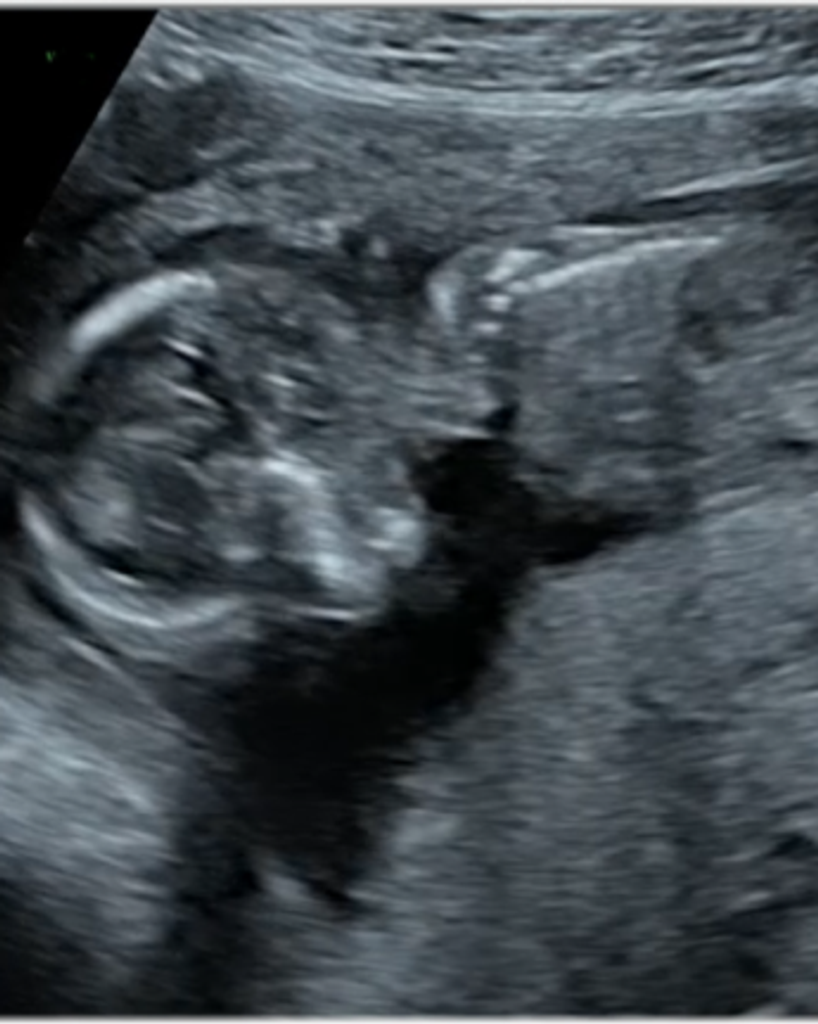 Judah Glenn Elliott Profile Photo