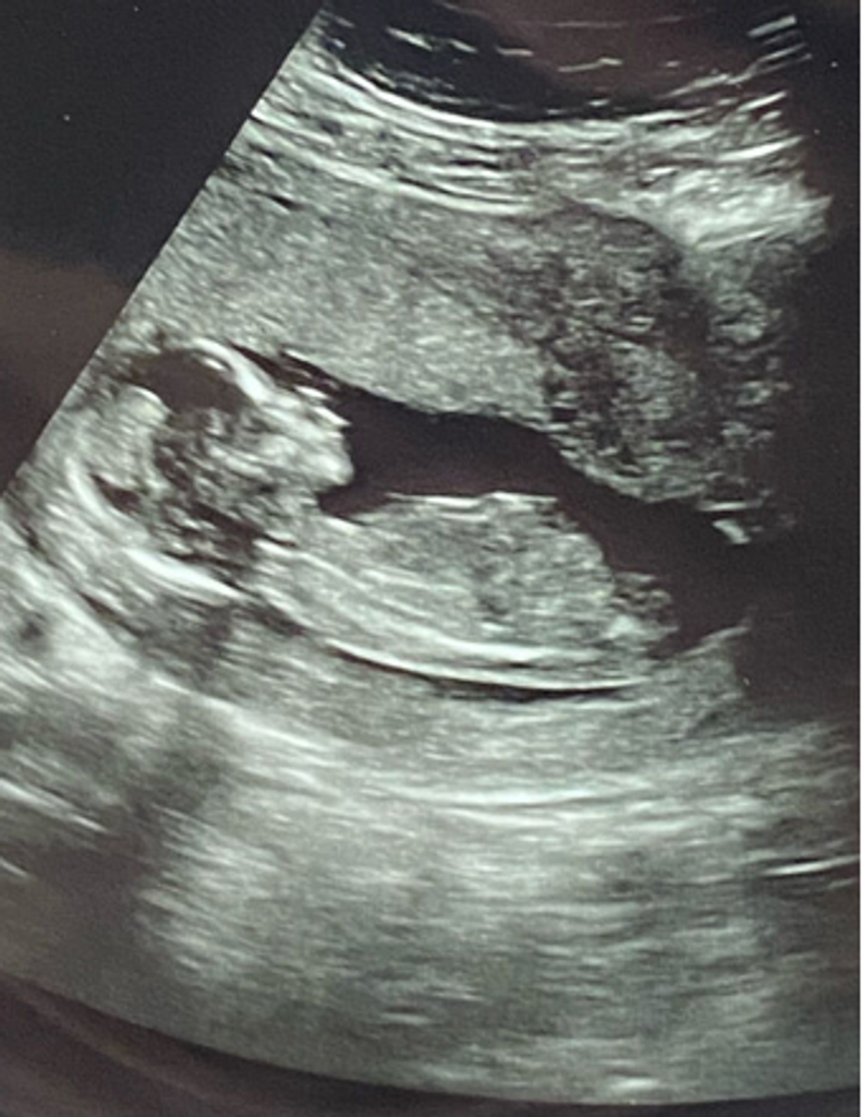 Everly Talon Varnadoe Profile Photo