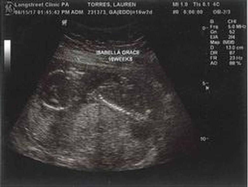 Isabella Grace Torres
