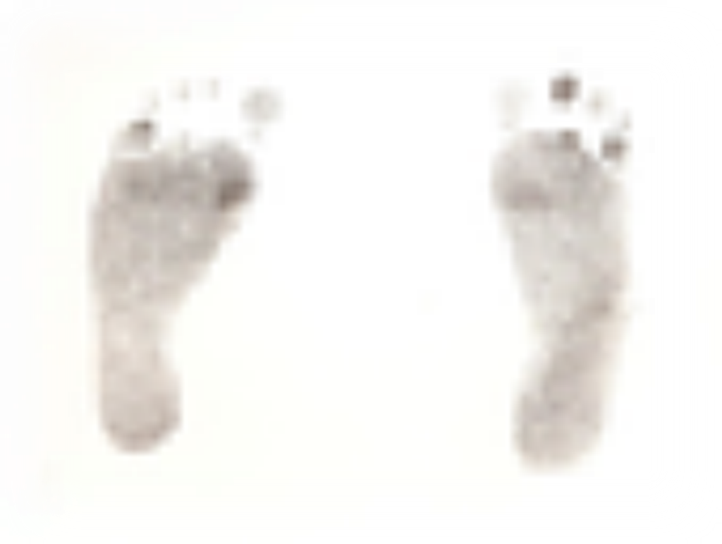Infant DeTroye