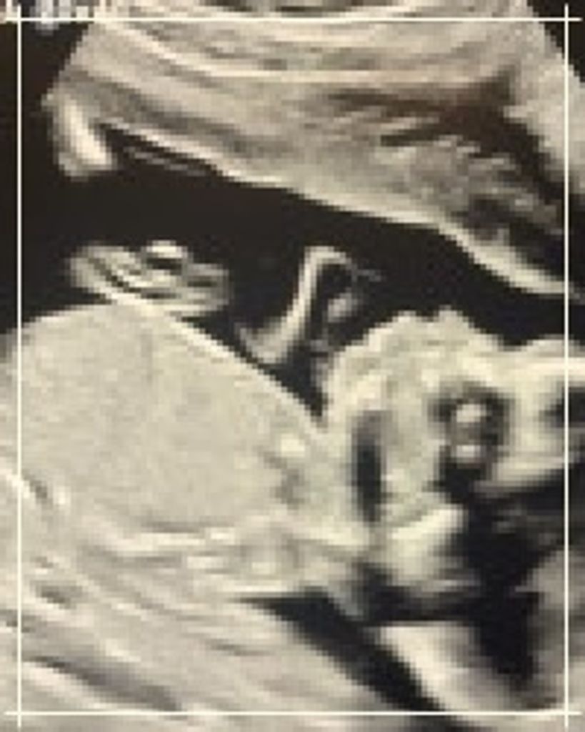 Sebastian Henry Hyde Profile Photo