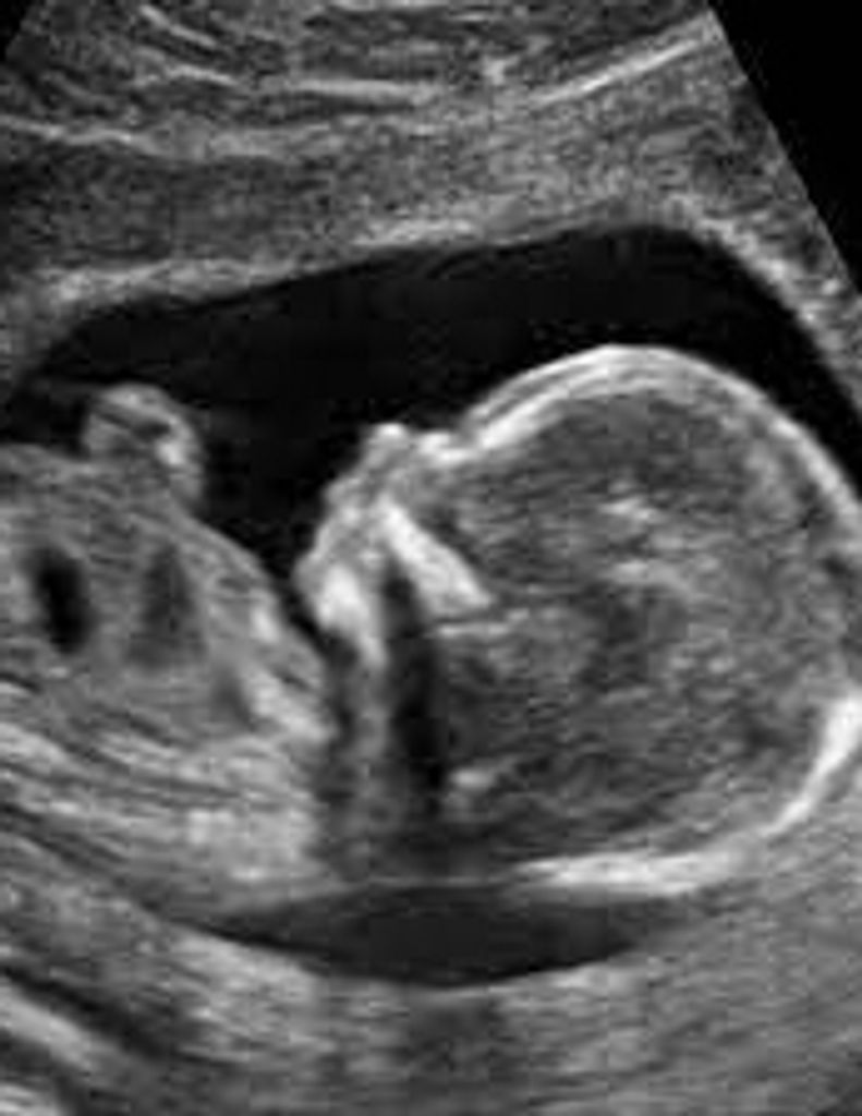 Janie Ashleigh Yvonne White-Holloway Profile Photo