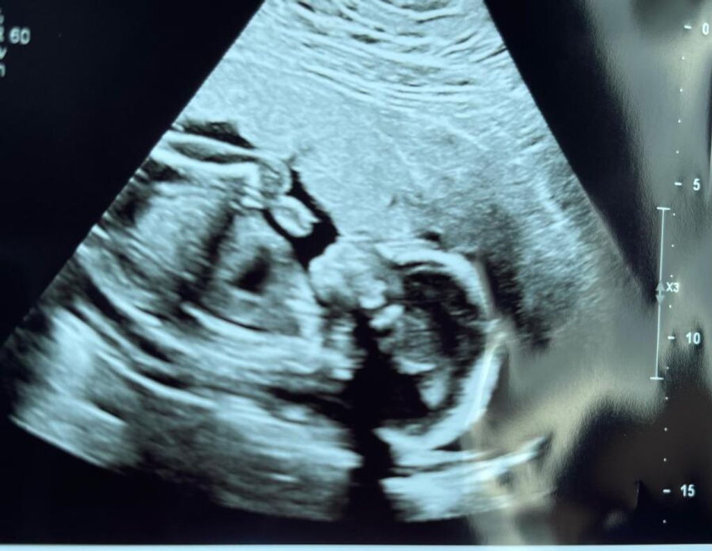Asher Rhodus Profile Photo