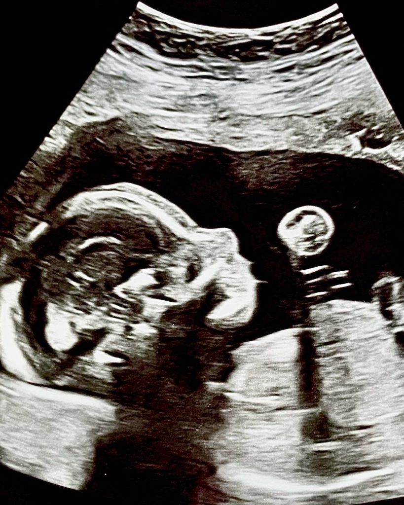 Rocco Damacio Pacheco