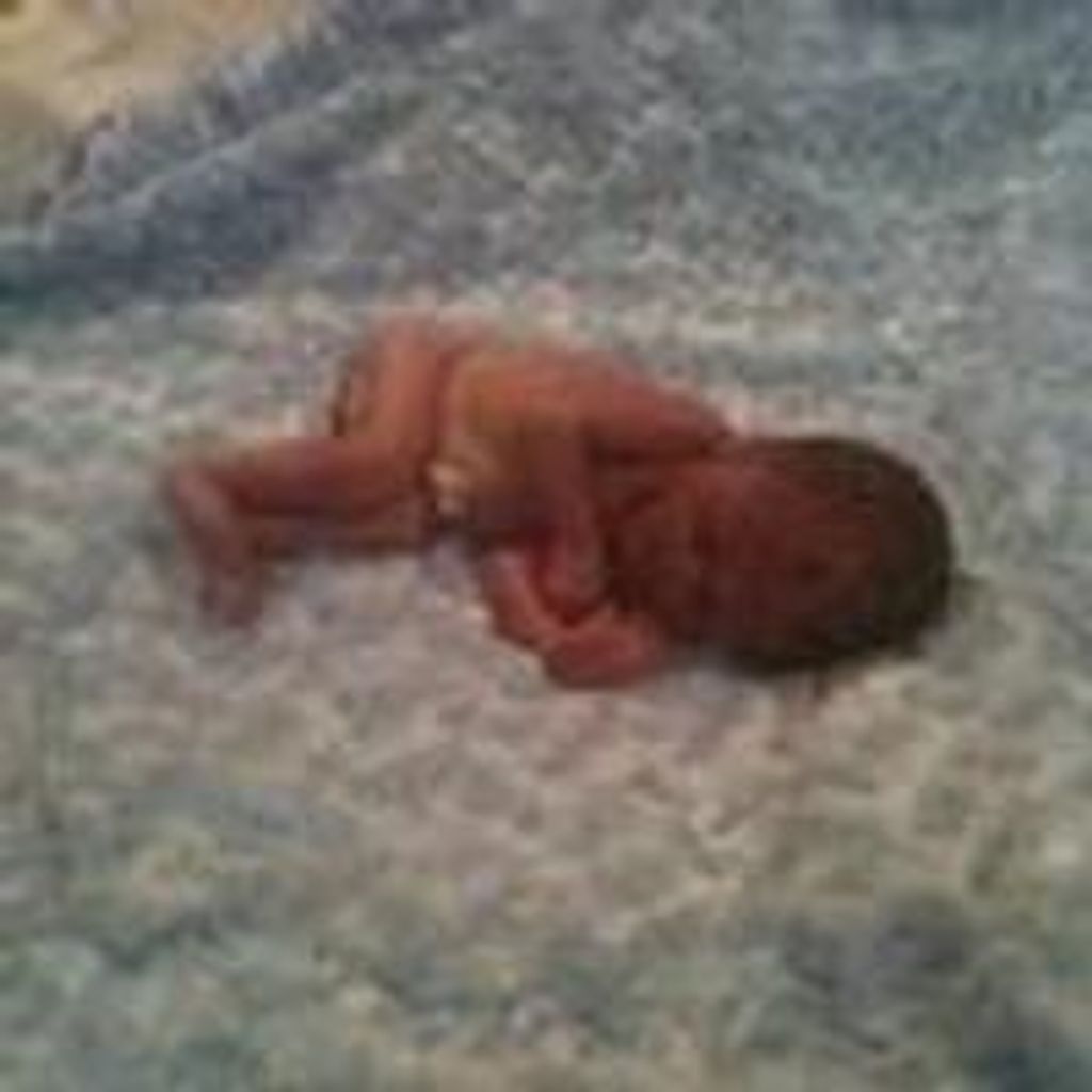 Carter Allen Cassel Profile Photo