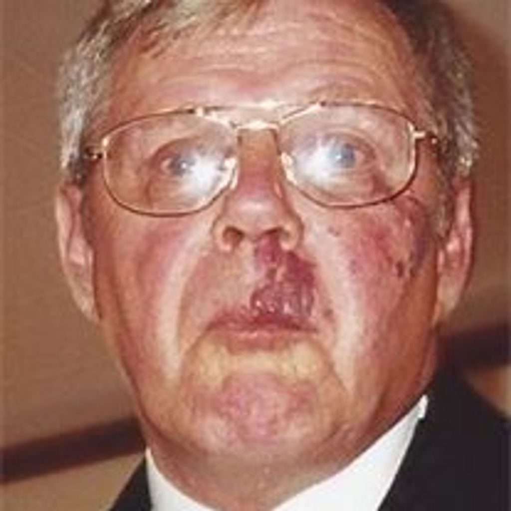 Francis E. Coleman