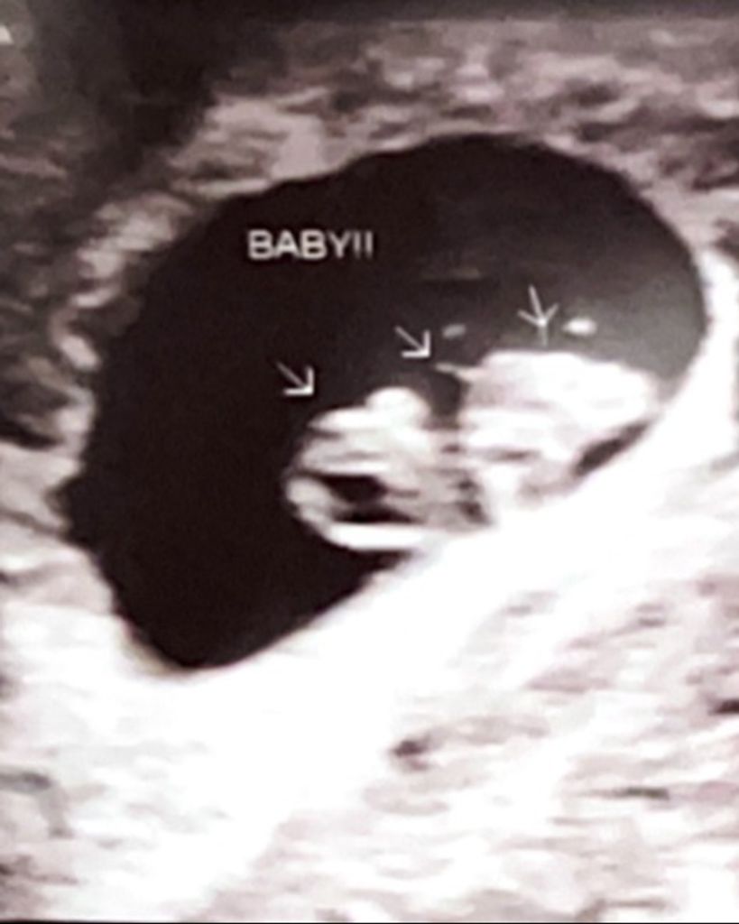 Arabella Reign Ammamoo