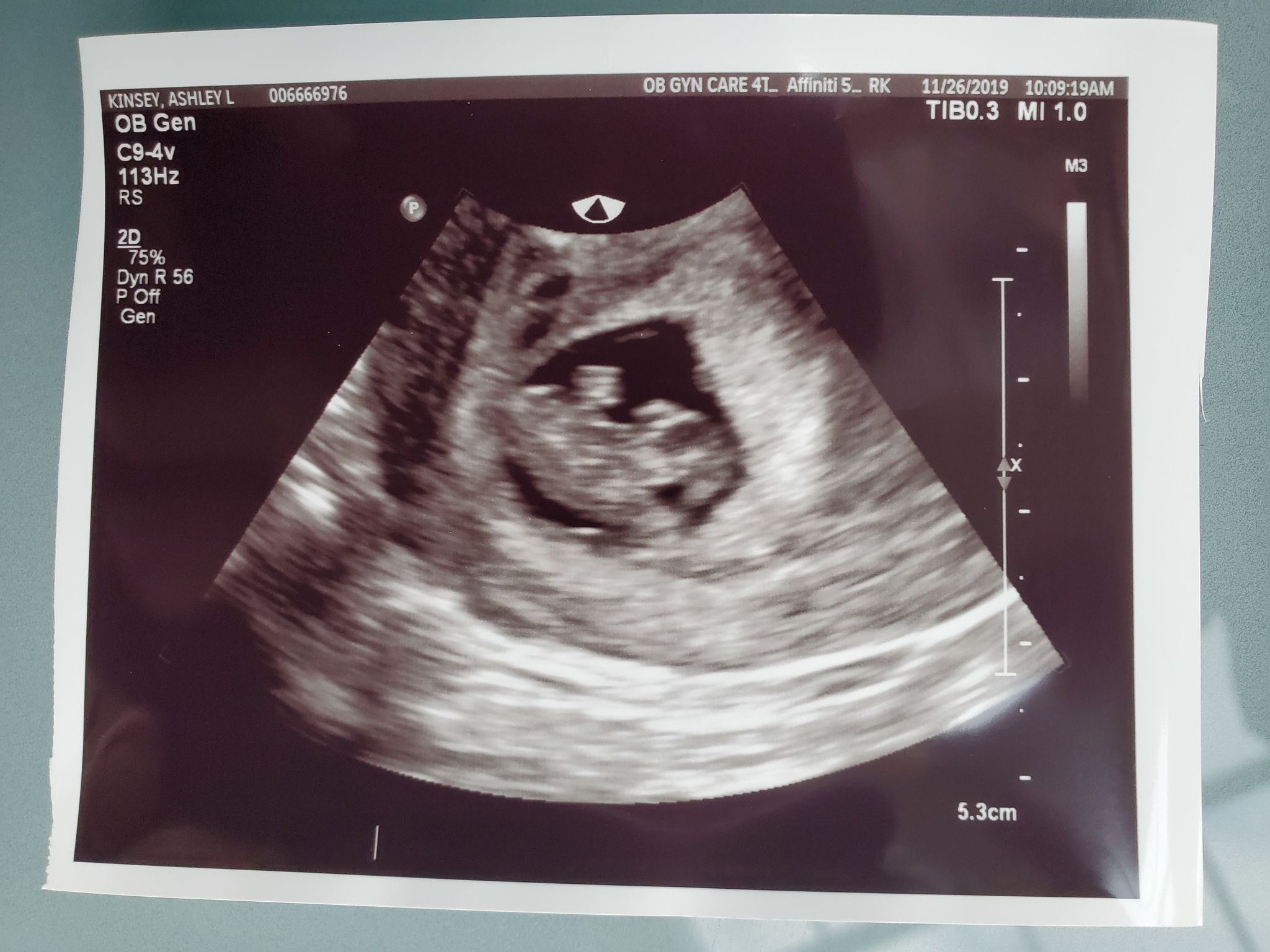 Wyatt Dean Kinsey photo gallery image 2 of 152