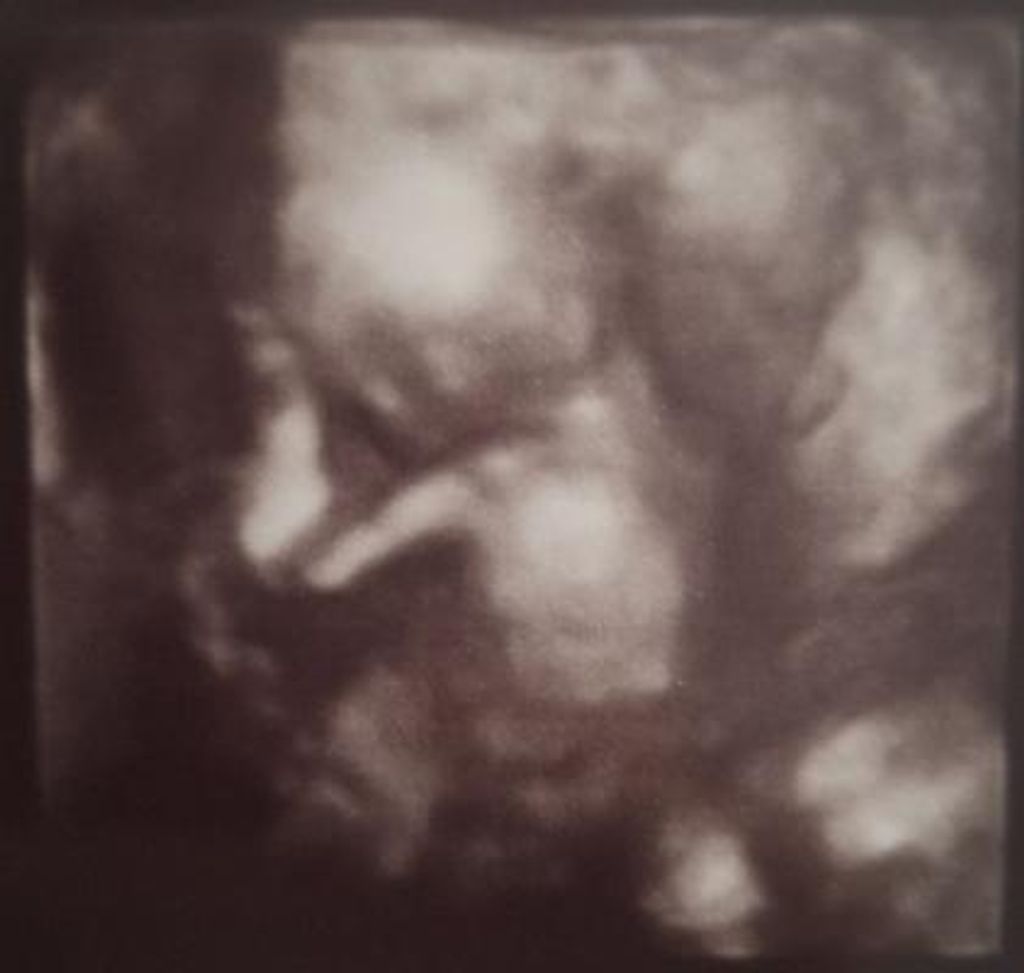 Baby Jade Rey Mendoza Profile Photo