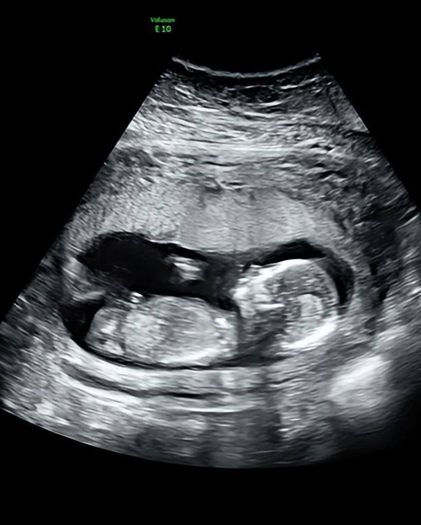 Bailey Sue Patterson