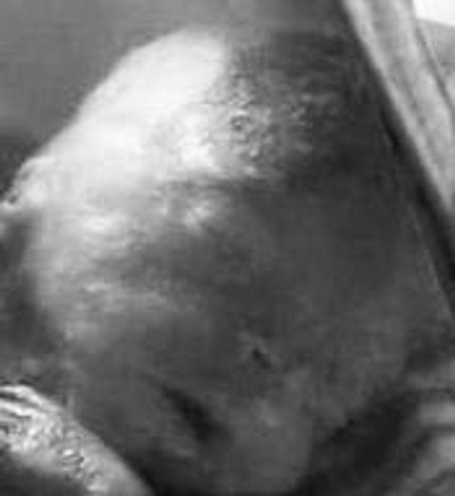 Gracelynn Ann Frieze