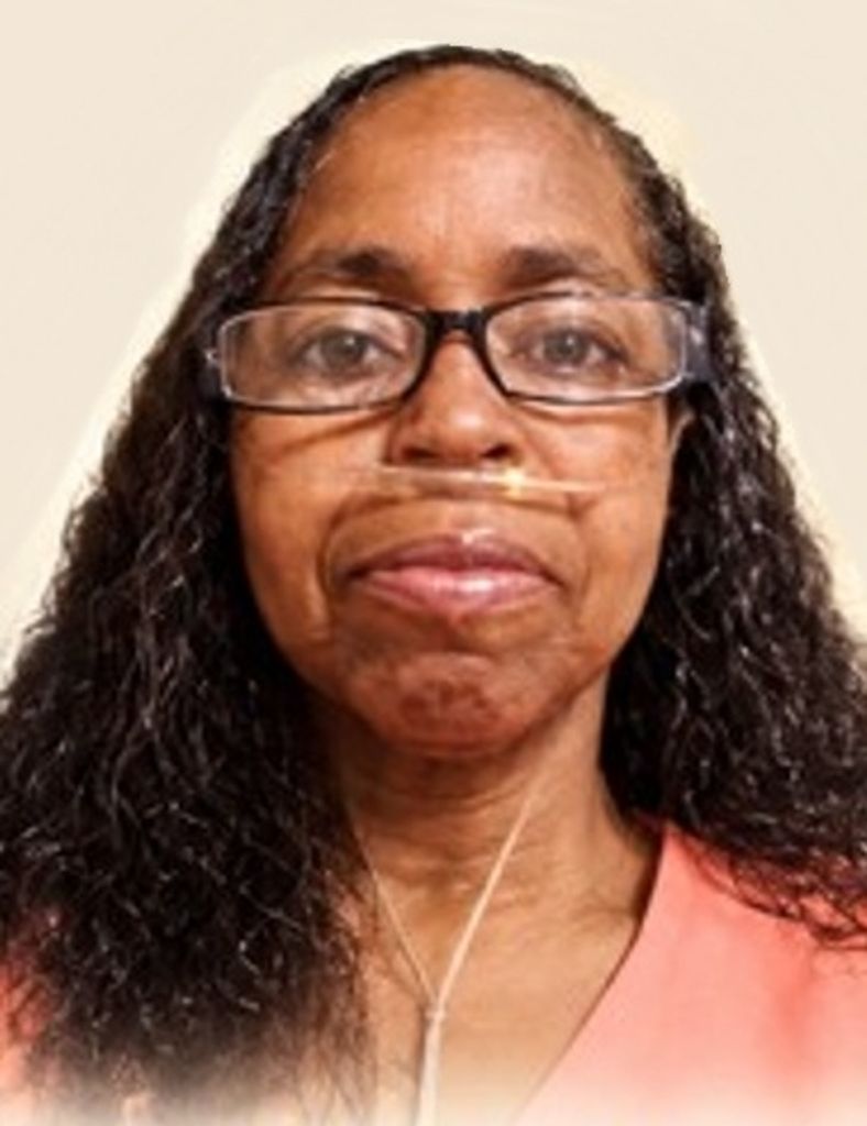 Patrice Lesure Profile Photo