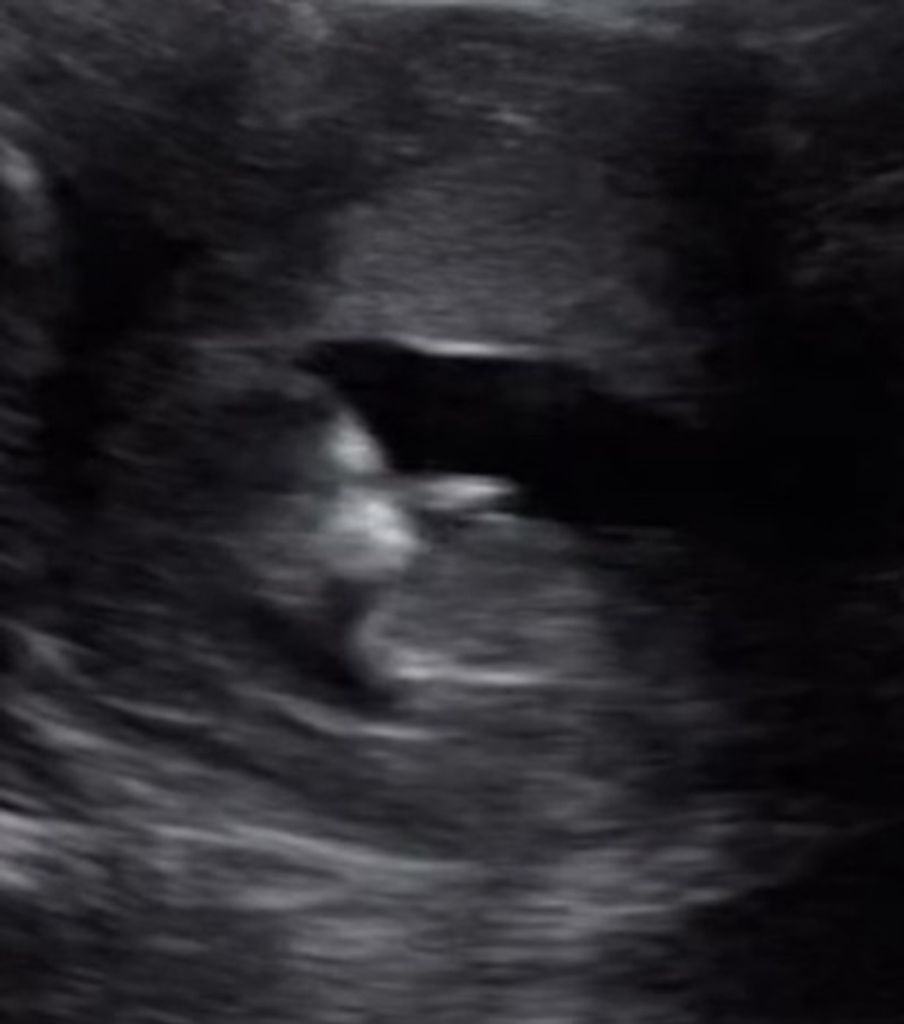 Adelyn Rose Warner