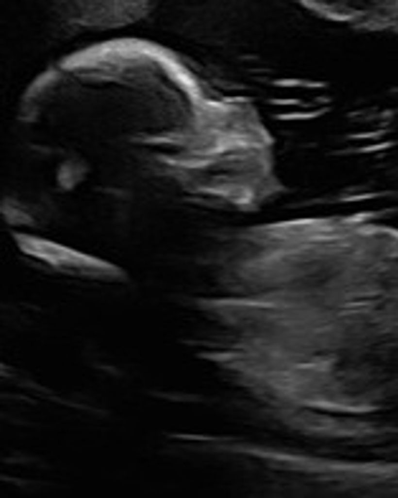 Blair Maylea-Lou Roberts