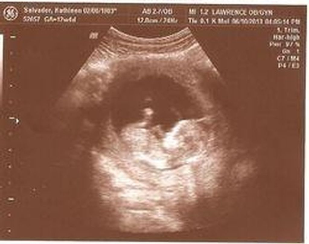 Baby Salvador Profile Photo