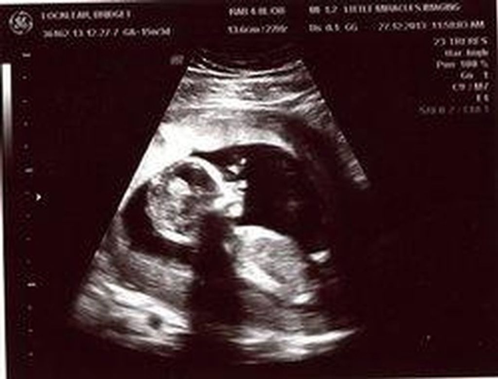 Baby Omari Noel Joinville