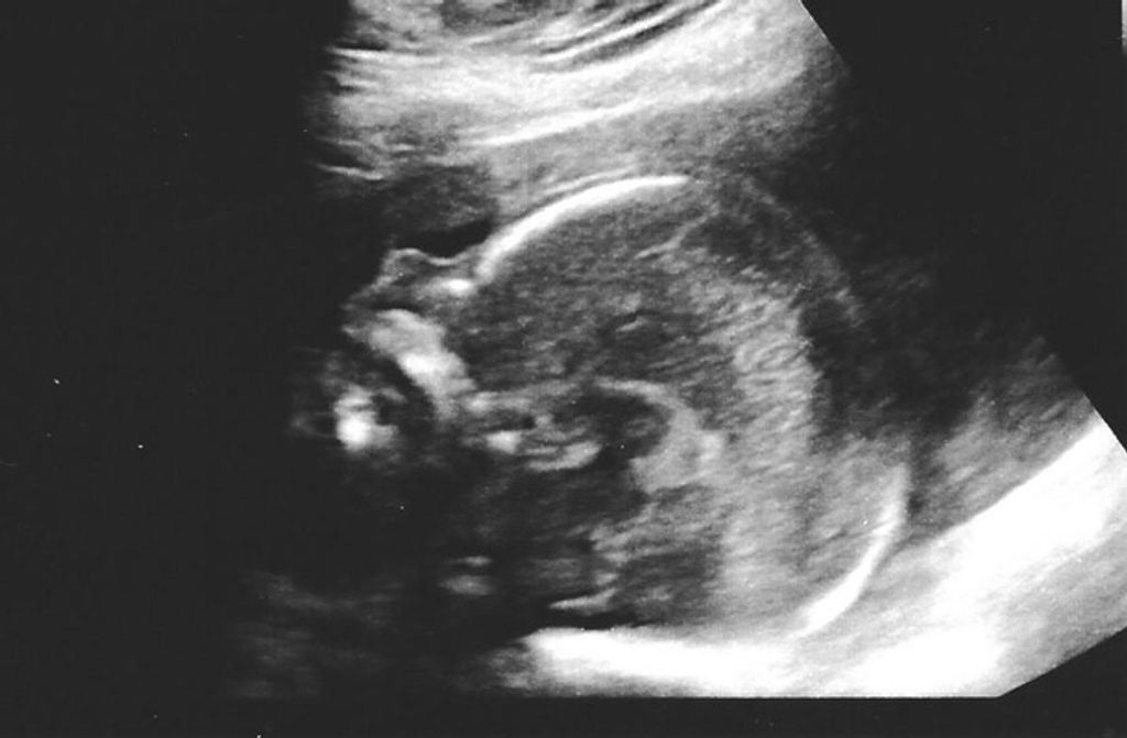 Rafe Ellis Deurmeier