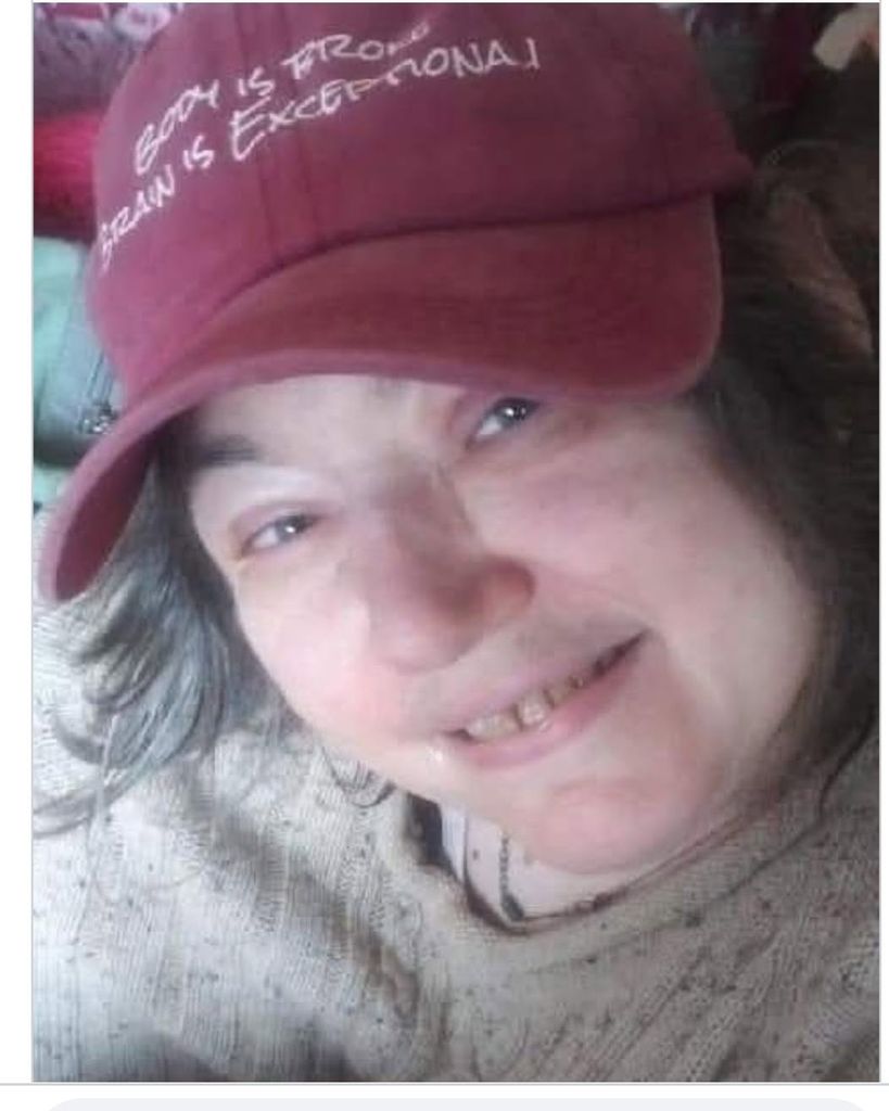 Lynda Alberson