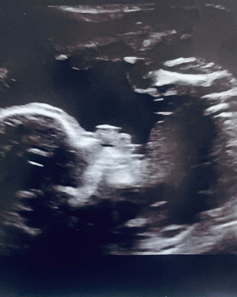 Miah Josephine Fitzherbert Profile Photo
