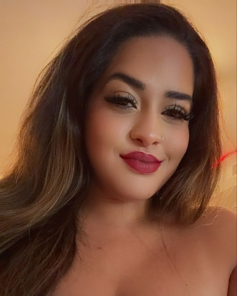 Wilnely Rodriguez - Albino Profile Photo