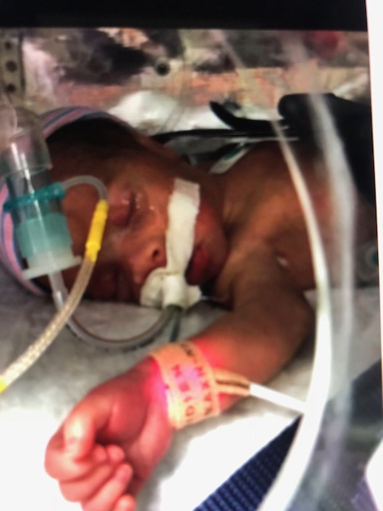 Rylan James Townsend Lafountain Graft Day Old Profile Photo