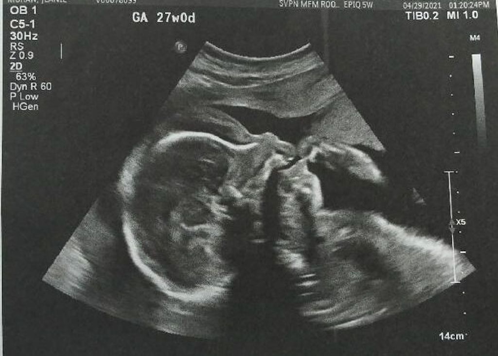 Baylor Zay’N Spottedbird Infant Son Of J’Lanie Moran And Dwain Spottedbird