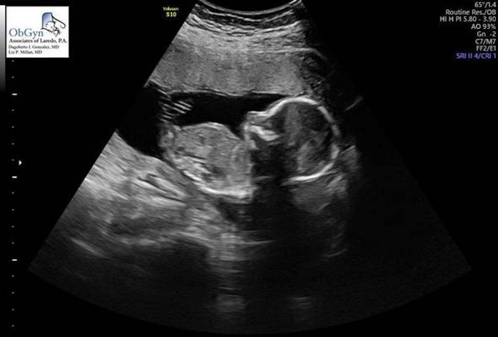 Baby Amilia Sophia Hinojosa Profile Photo
