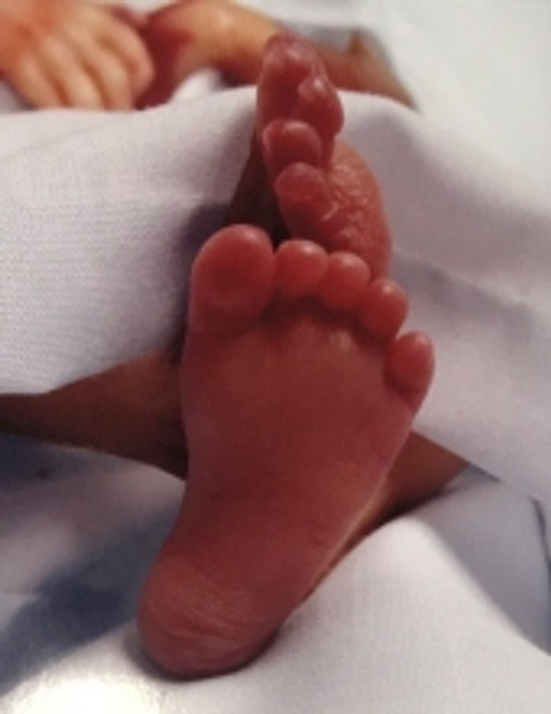 Britton Dean Wallace