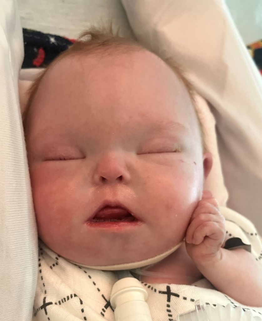 Opie Eichhorn