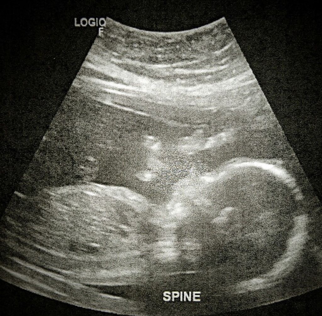 Kataleya Renesmee Hamilton