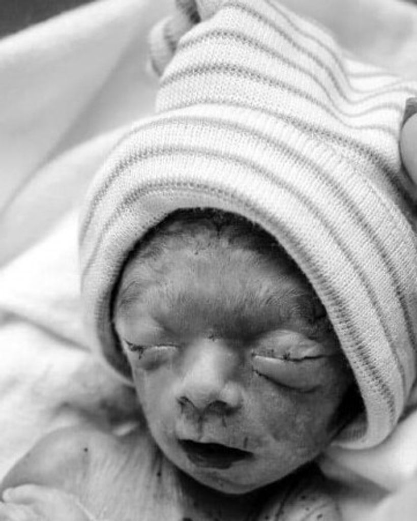 Fetal Noah Gene Elizondo