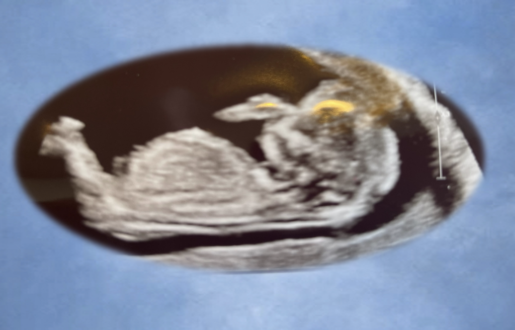 Baby Boy  Taylor Profile Photo