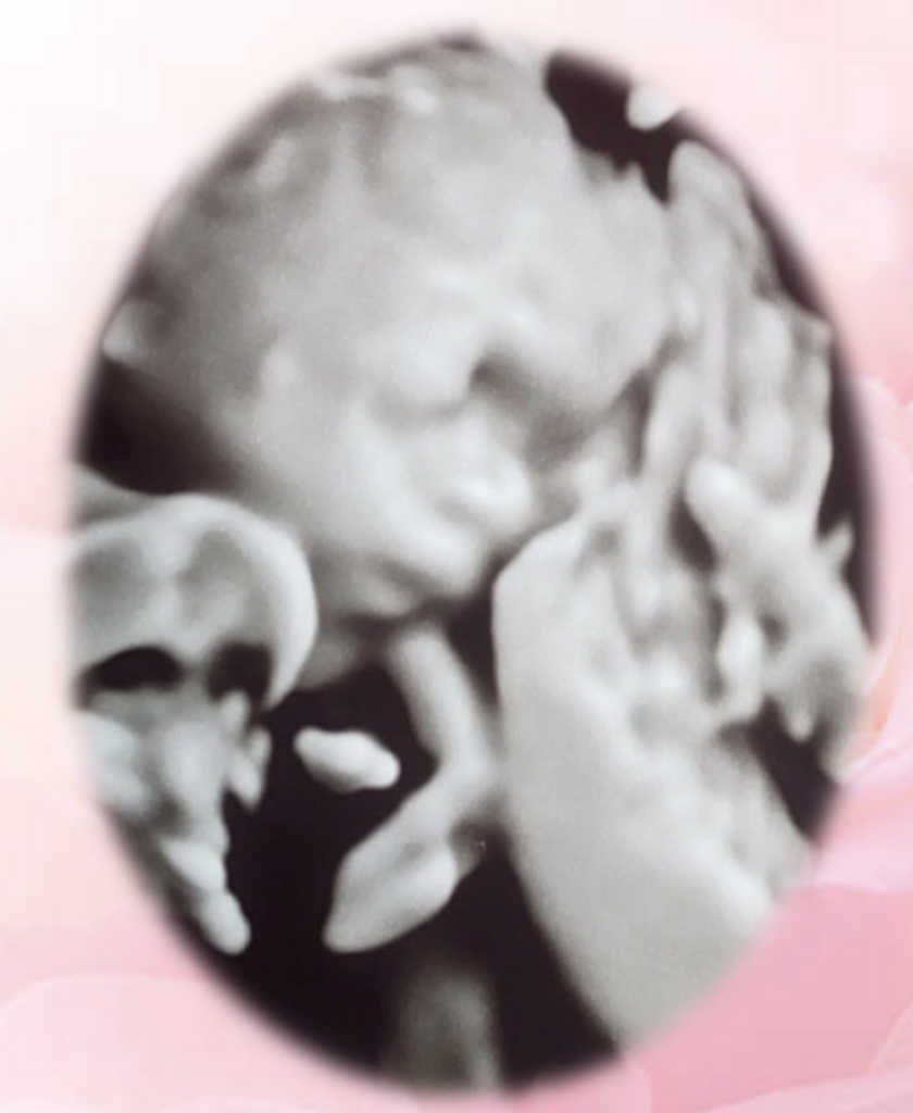 Amilliana Autumn Atkins Profile Photo