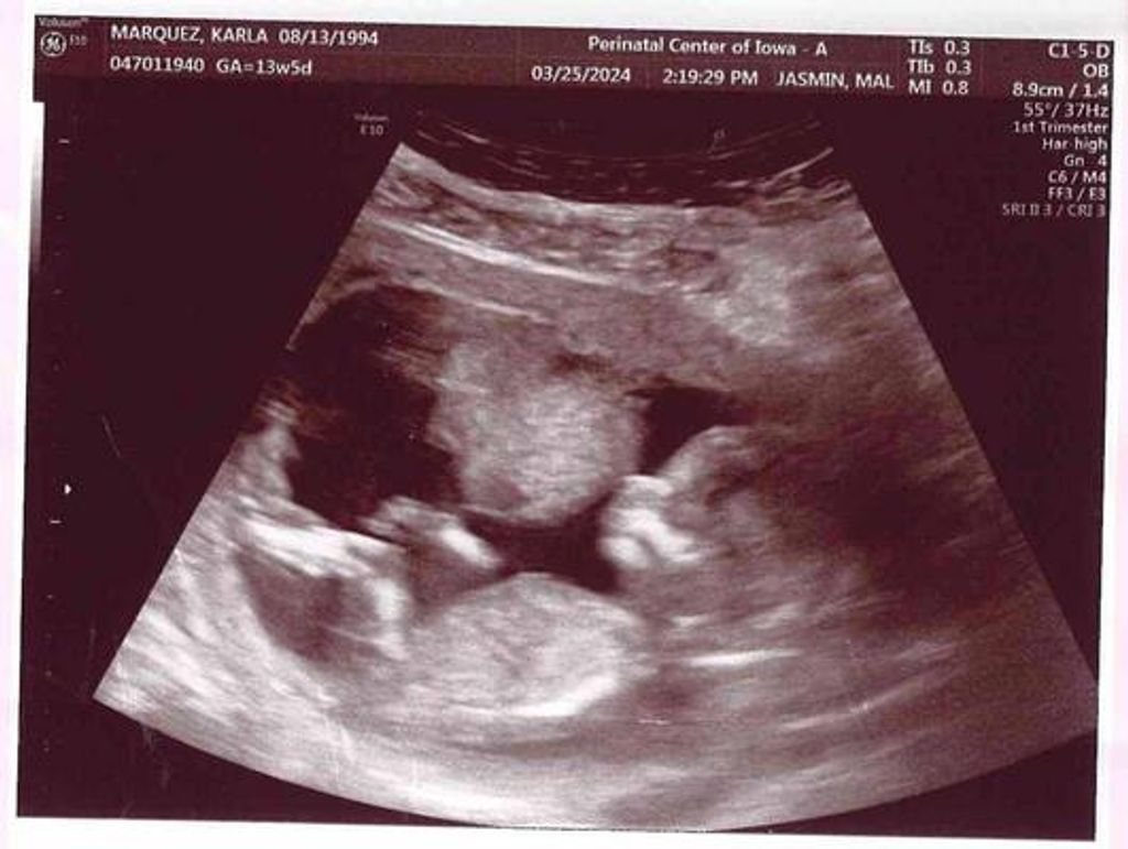 Angel Jaziel Moreno Marquez Profile Photo