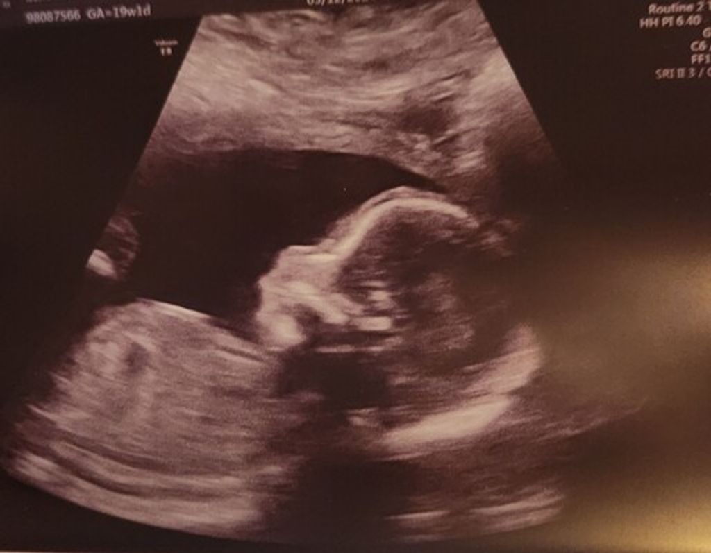 Mateo Ray Schoenherr Profile Photo