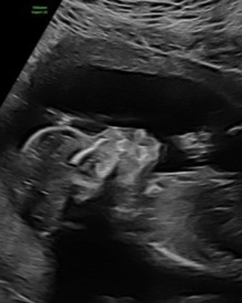 Enzo Elijah Martinez