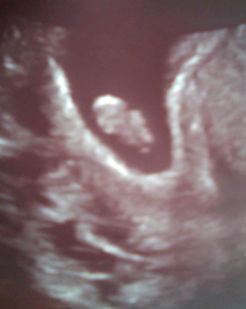 Baby Raney Profile Photo