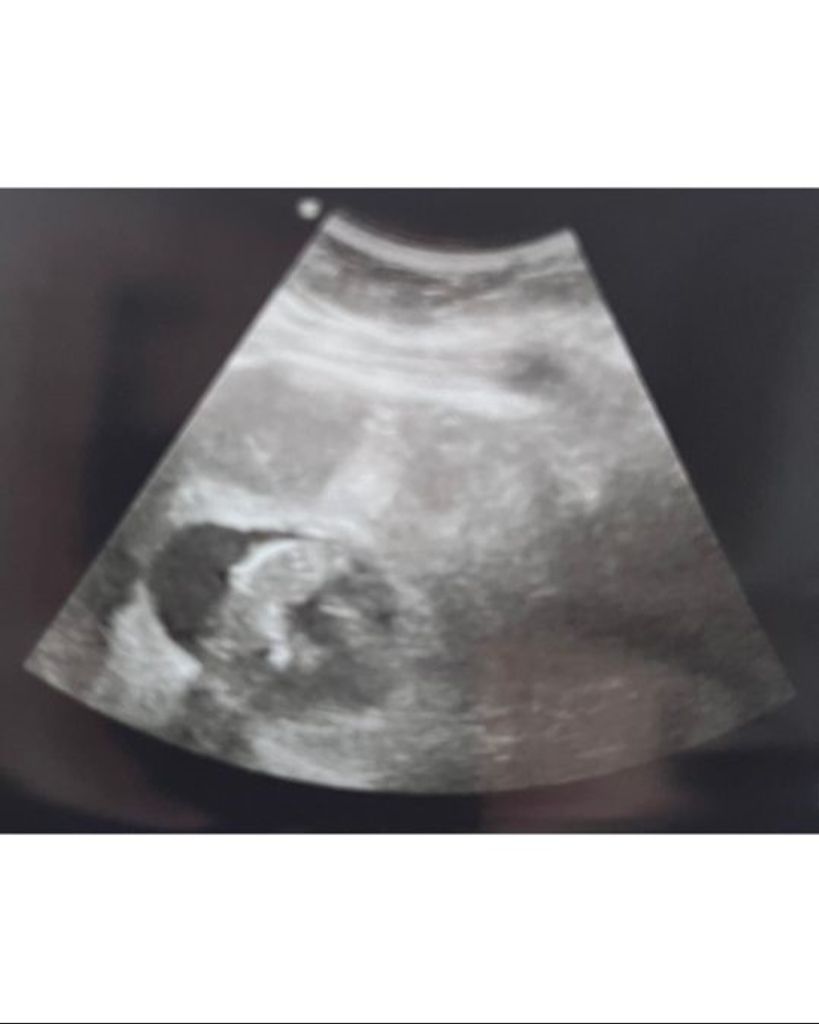 Carlee Jay Dowdell Profile Photo