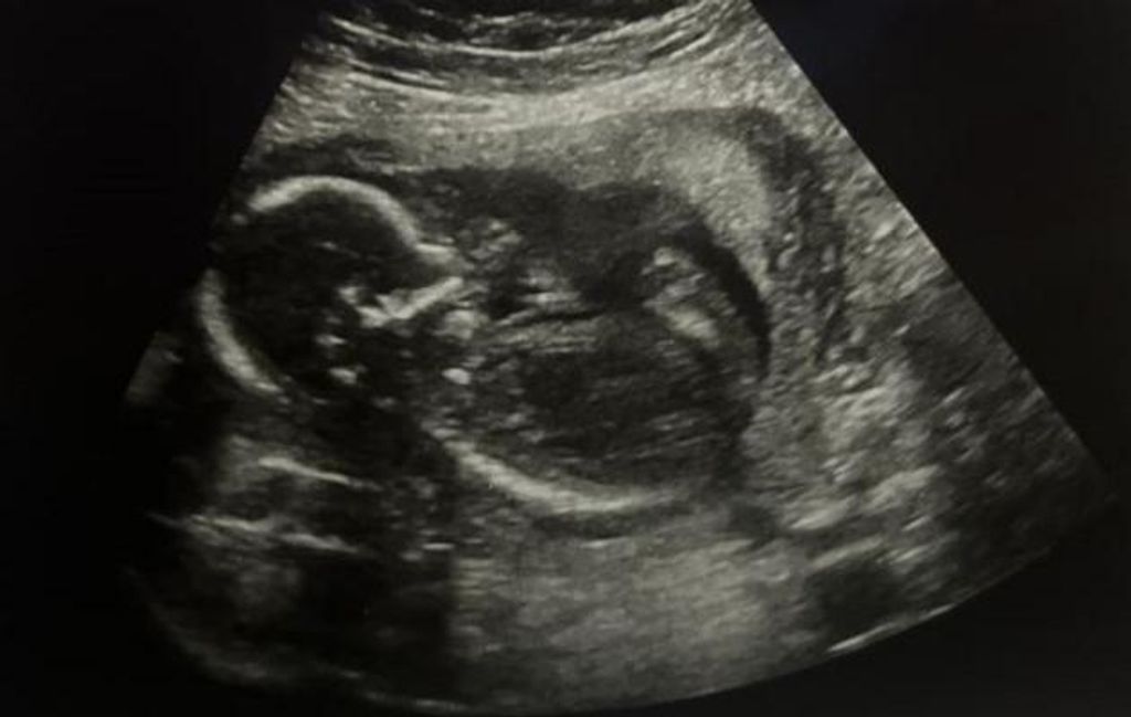 Baby Morley Melvin Madore Profile Photo