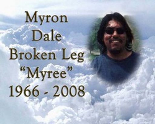 Myron Dale Broken Leg