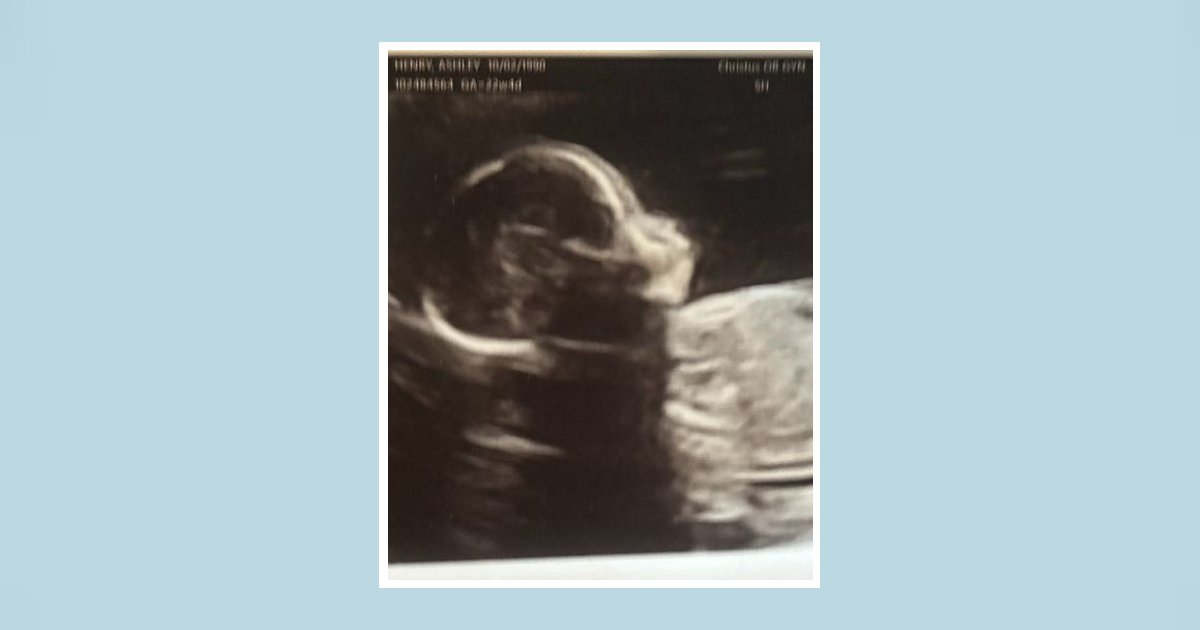 Jensen Lane Henry Obituary, Kemp, TX